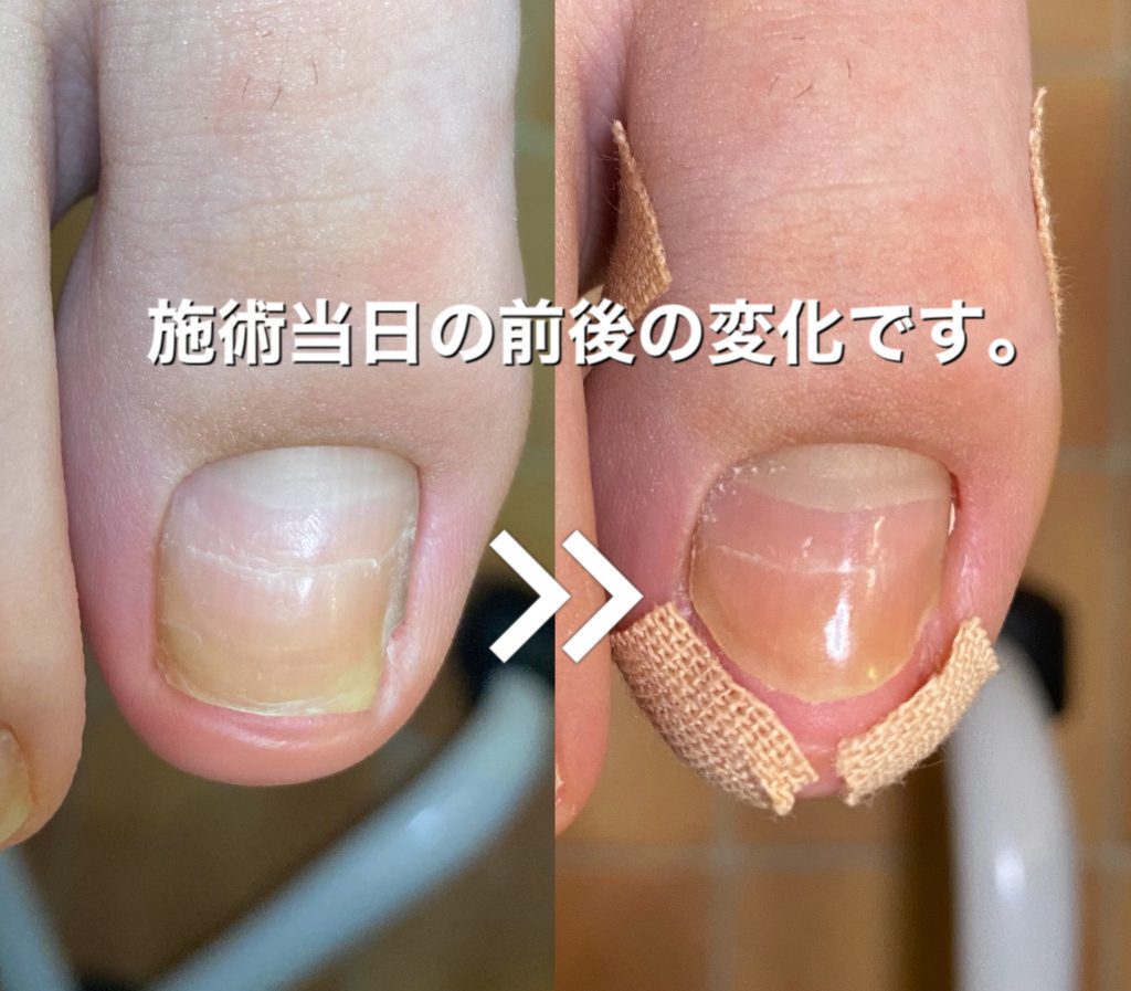 Foot Care Salon Runka フットケアサロン ランカ