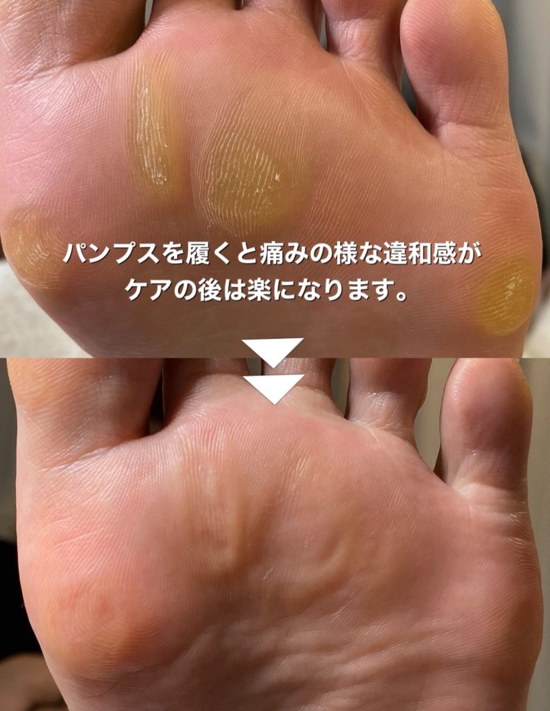 角質 Foot Care Salon Runka