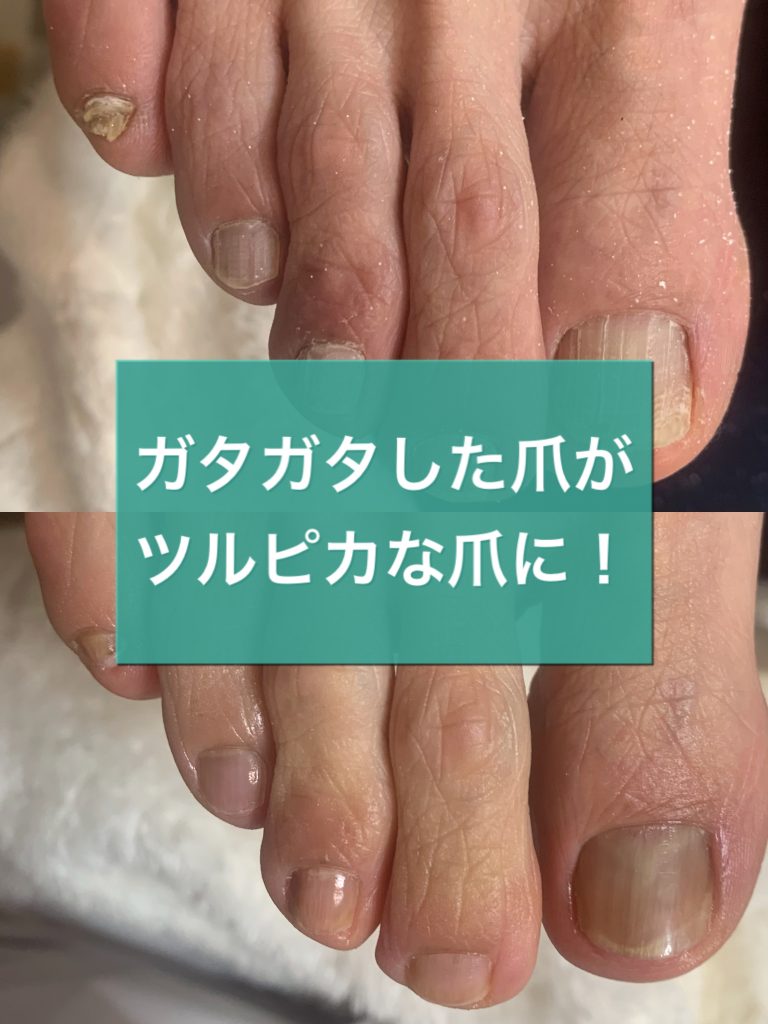 Foot Care Salon Runka フットケアサロン ランカ