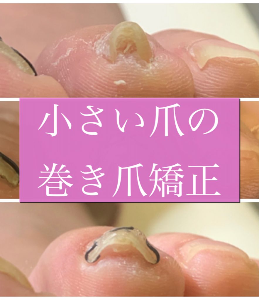 Foot Care Salon Runka フットケアサロン ランカ