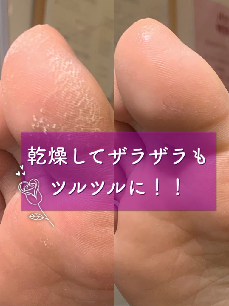 Foot Care Salon Runka フットケアサロン ランカ