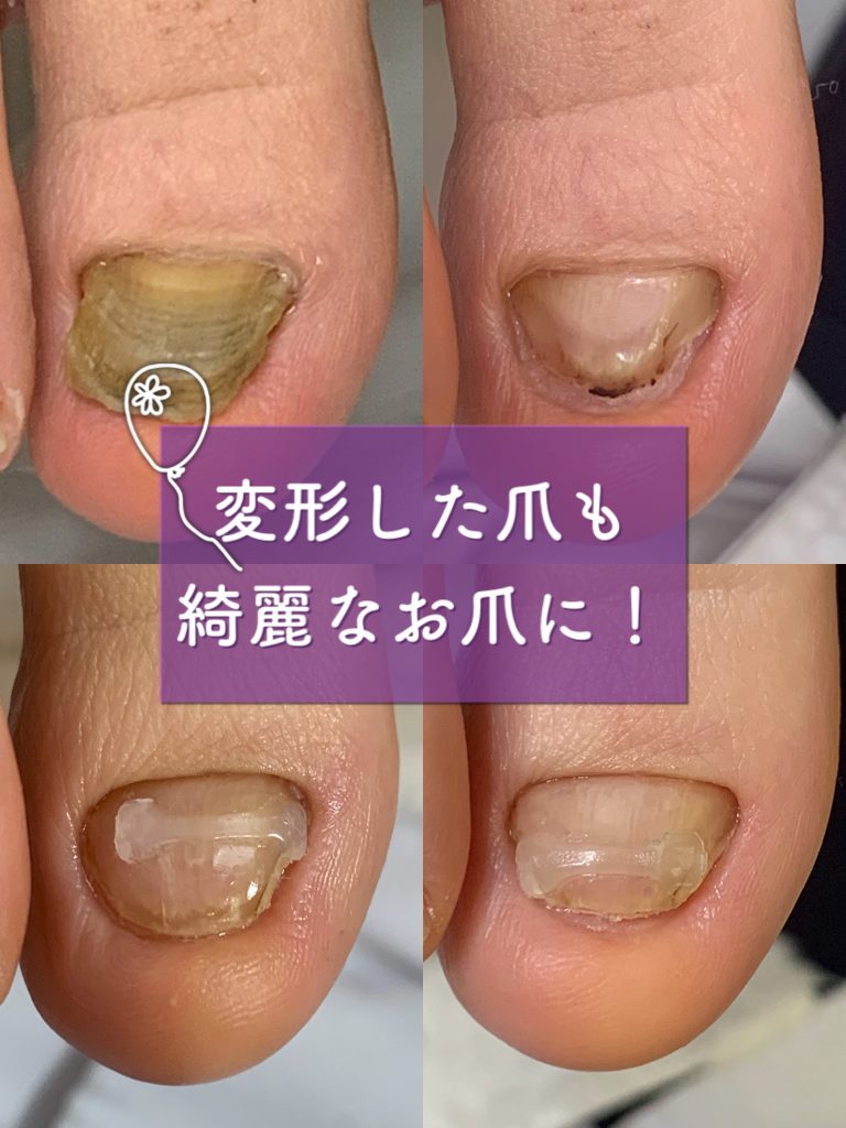 Foot Care Salon Runka フットケアサロン ランカ