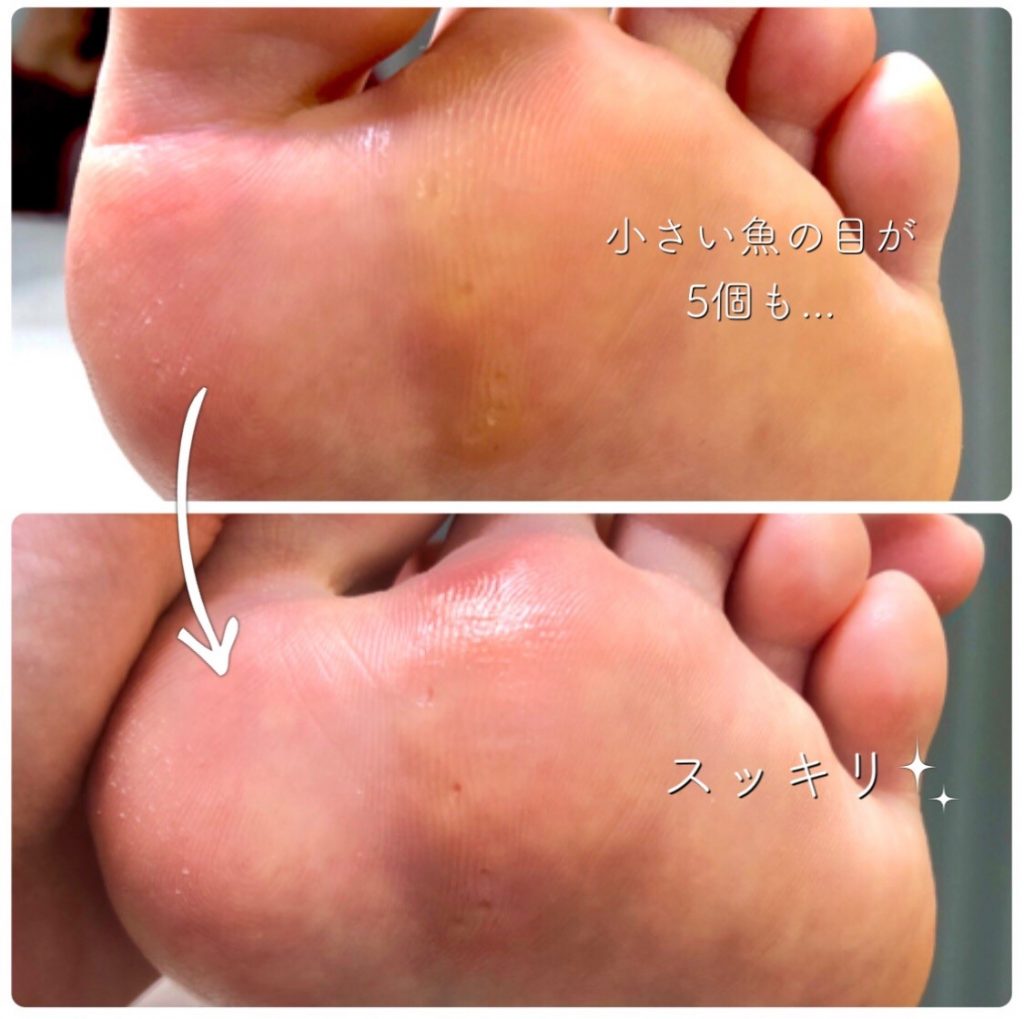 Foot Care Runka フットケア ランカ 銀座巻き爪矯正センター