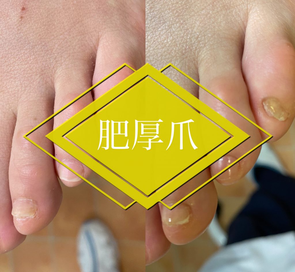 Foot Care Salon Runka フットケアサロン ランカ