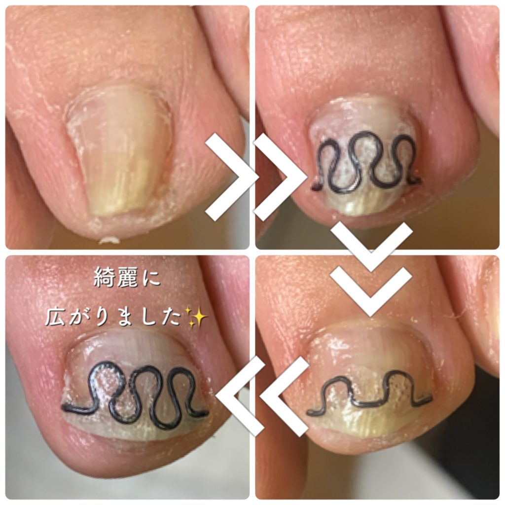 Foot Care Salon Runka フットケアサロン ランカ