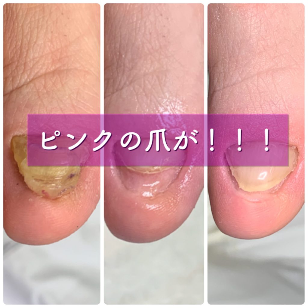 Foot Care Salon Runka フットケアサロン ランカ